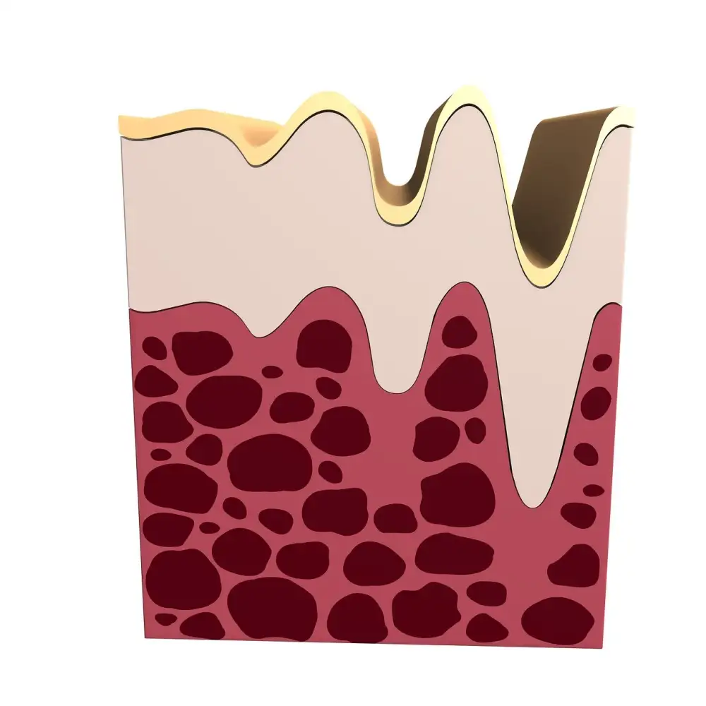 Collagen For Gum Recession